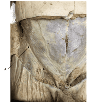 Quiz: Anatomy_Lab3